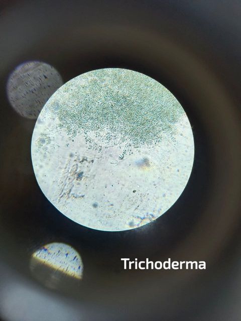 Chế phẩm sinh học Trichoderma (gói 1kg)